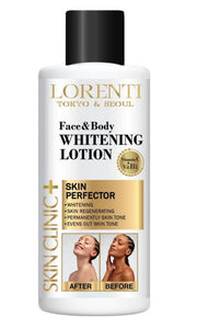 Lotiune pentru inalbire Lorenti whitening lotion 500 ml